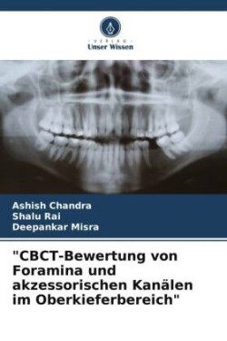 "CBCT-Bewertung von Foramina und akzessorischen Kanälen im Oberkieferbereich"