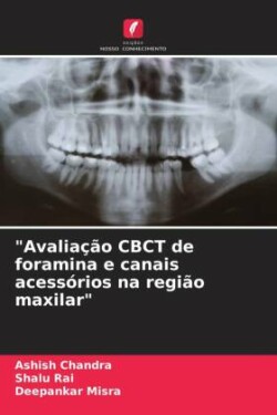 "Avaliação CBCT de foramina e canais acessórios na região maxilar"