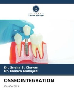 OSSEOINTEGRATION