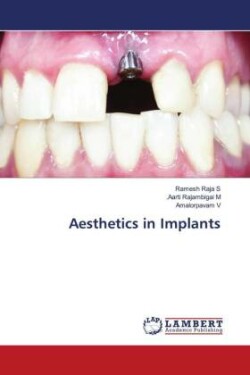 Aesthetics in Implants