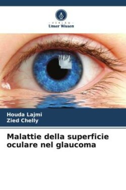 Malattie della superficie oculare nel glaucoma