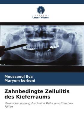 Zahnbedingte Zellulitis des Kieferraums