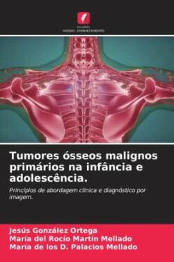 Tumores ósseos malignos primários na infância e adolescência.