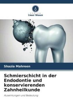 Schmierschicht in der Endodontie und konservierenden Zahnheilkunde