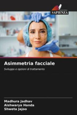 Asimmetria facciale