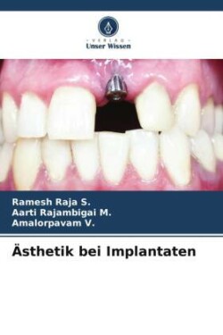 Ästhetik bei Implantaten