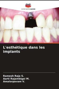 L'esthétique dans les implants