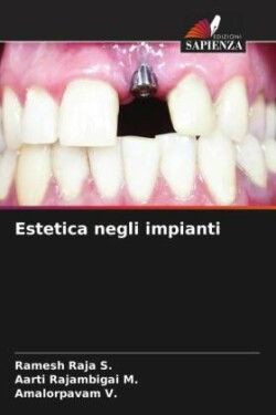 Estetica negli impianti