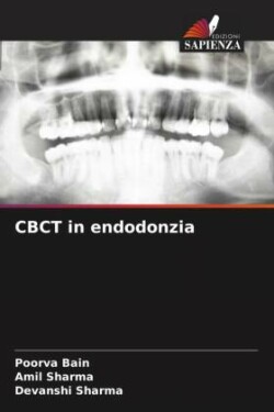 CBCT in endodonzia