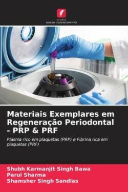 Materiais Exemplares em Regeneração Periodontal - PRP & PRF