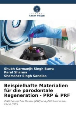 Beispielhafte Materialien für die parodontale Regeneration - PRP & PRF