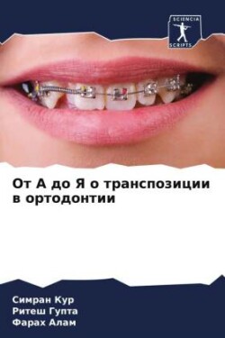 От А до Я о транспозиции в ортодонтии