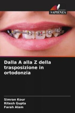 Dalla A alla Z della trasposizione in ortodonzia