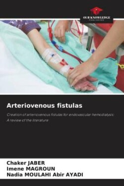 Arteriovenous fistulas