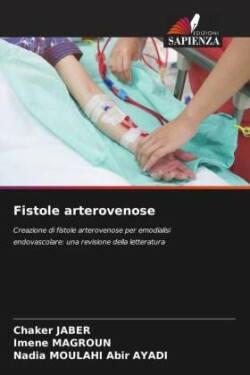 Fistole arterovenose