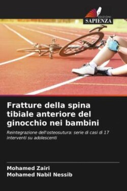 Fratture della spina tibiale anteriore del ginocchio nei bambini