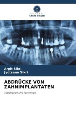 Abdrücke Von Zahnimplantaten