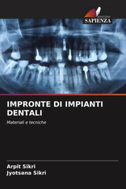 Impronte Di Impianti Dentali