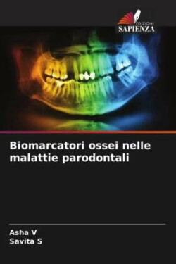 Biomarcatori ossei nelle malattie parodontali