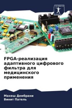 FPGA-реализация адаптивного цифрового фильт&#1