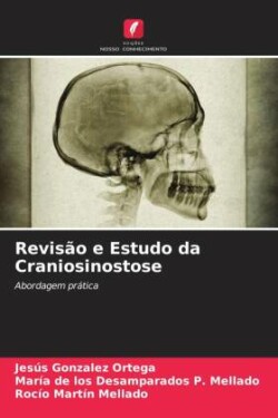 Revisão e Estudo da Craniosinostose