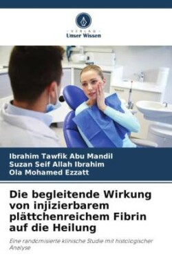 Die begleitende Wirkung von injizierbarem plättchenreichem Fibrin auf die Heilung