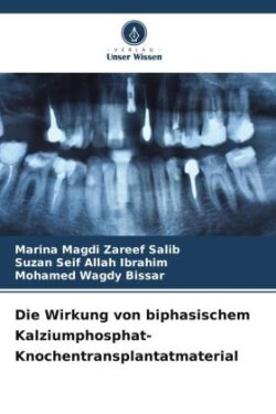 Die Wirkung von biphasischem Kalziumphosphat-Knochentransplantatmaterial