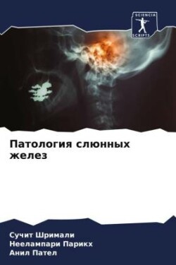 Patologiq slünnyh zhelez