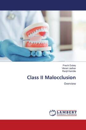 Class II Malocclusion