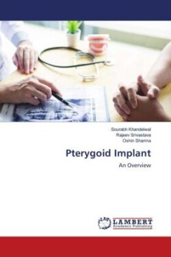 Pterygoid Implant