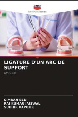 Ligature d'Un ARC de Support