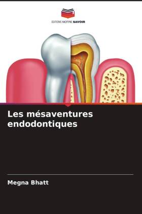 Les mésaventures endodontiques