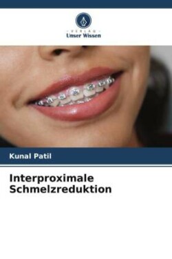 Interproximale Schmelzreduktion