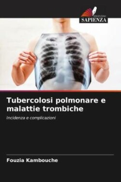 Tubercolosi polmonare e malattie trombiche