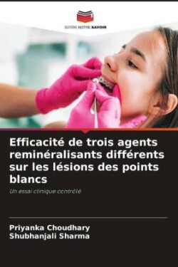 Efficacité de trois agents reminéralisants différents sur les lésions des points blancs