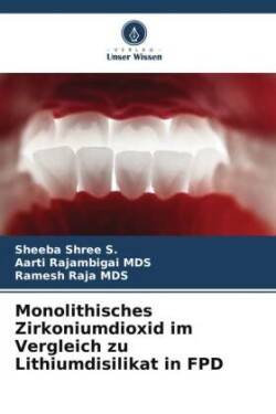 Monolithisches Zirkoniumdioxid im Vergleich zu Lithiumdisilikat in FPD