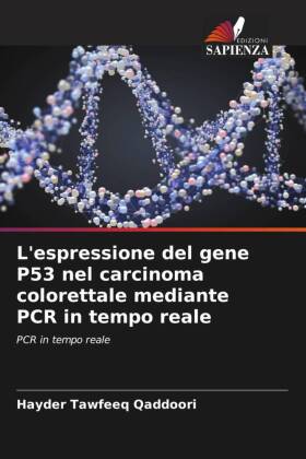 L'espressione del gene P53 nel carcinoma colorettale mediante PCR in tempo reale