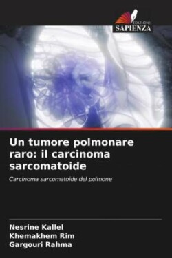tumore polmonare raro