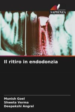 ritiro in endodonzia