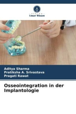 Osseointegration in der Implantologie