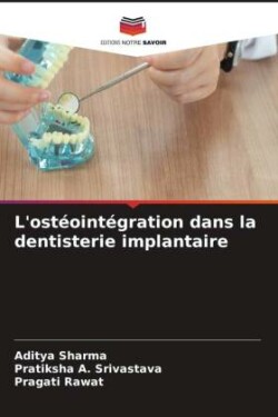 L'ostéointégration dans la dentisterie implantaire