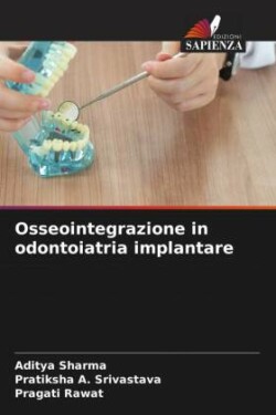 Osseointegrazione in odontoiatria implantare