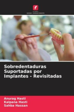 Sobredentaduras Suportadas por Implantes - Revisitadas