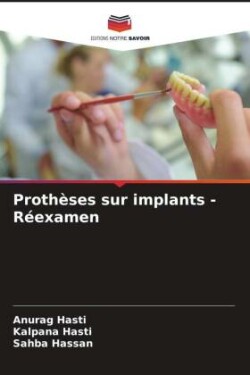 Prothèses sur implants - Réexamen