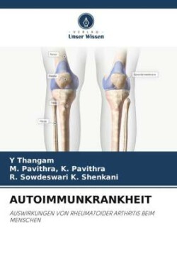 Autoimmunkrankheit