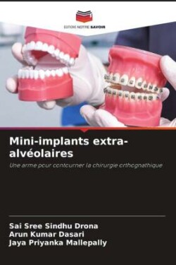 Mini-implants extra-alvéolaires