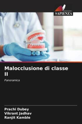 Malocclusione di classe II