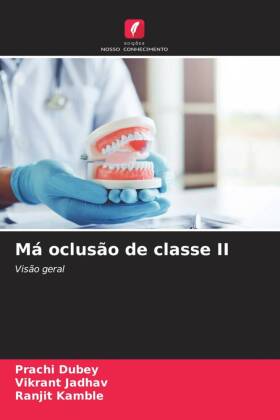 Má oclusão de classe II