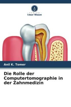 Rolle der Computertomographie in der Zahnmedizin