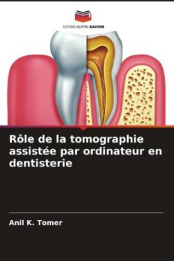 Rôle de la tomographie assistée par ordinateur en dentisterie